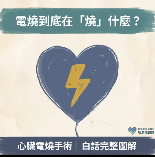 電燒到底在「燒」什麼？導管電燒白話解說