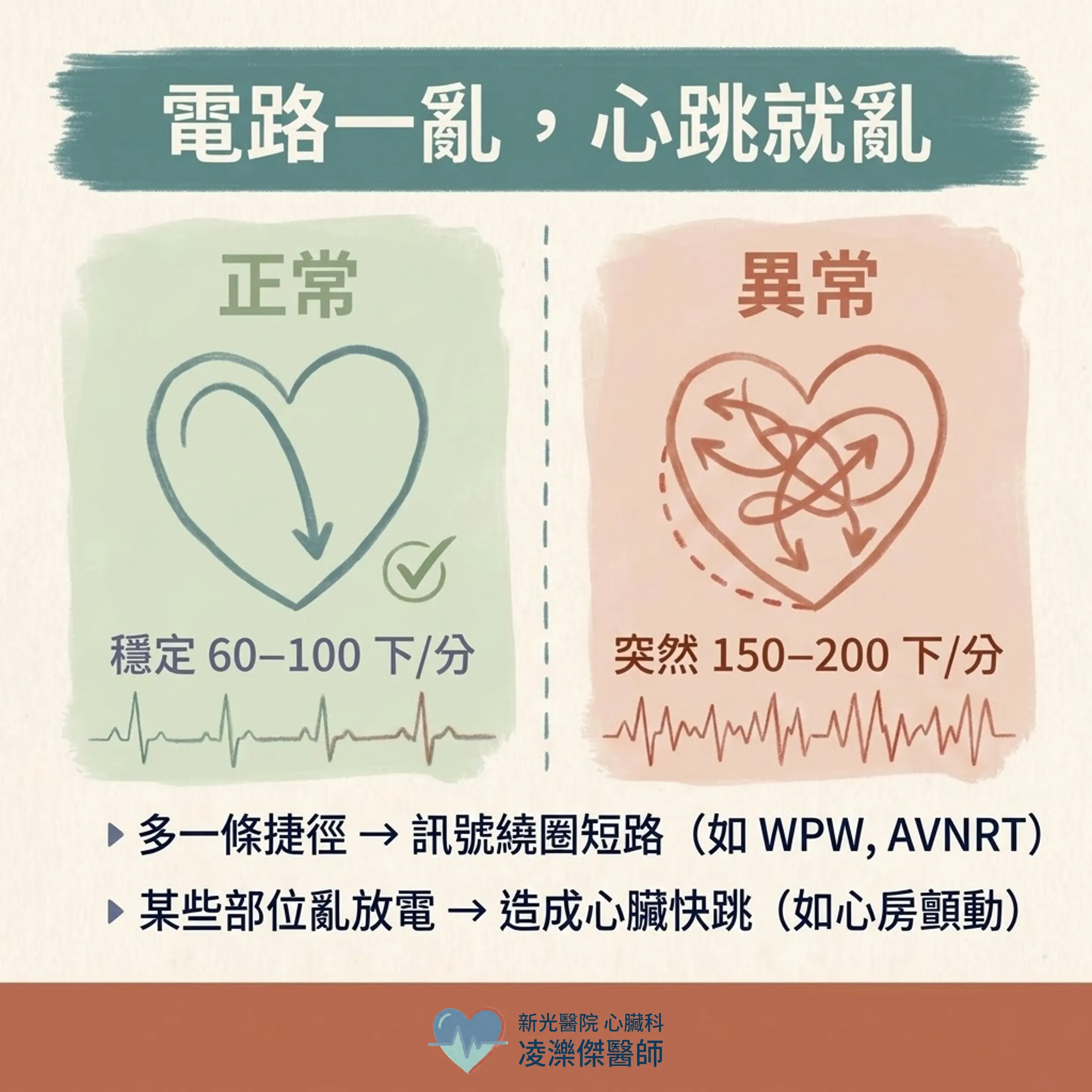 電燒到底在「燒」什麼?導管電燒白話解說 圖卡 3