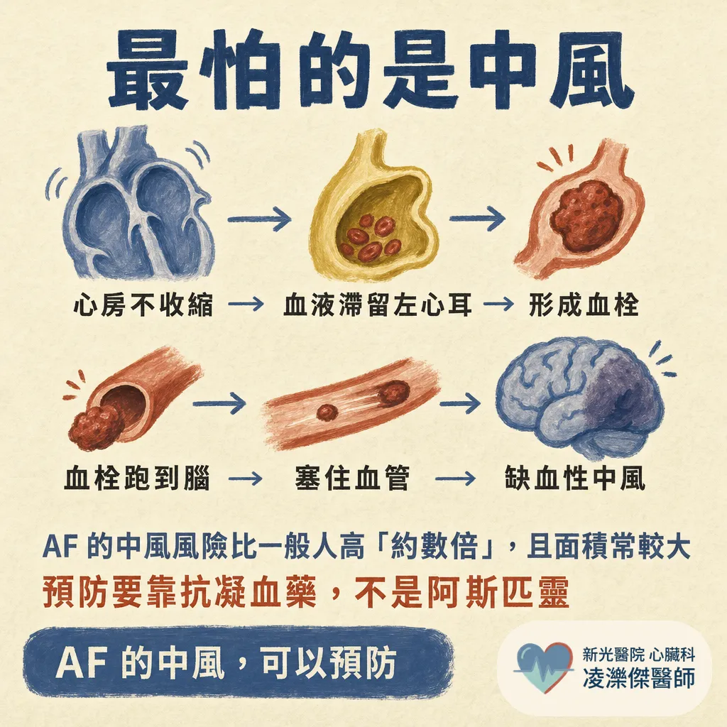 心房顫動是什麼?症狀、中風風險與治療一次看懂 圖卡 4