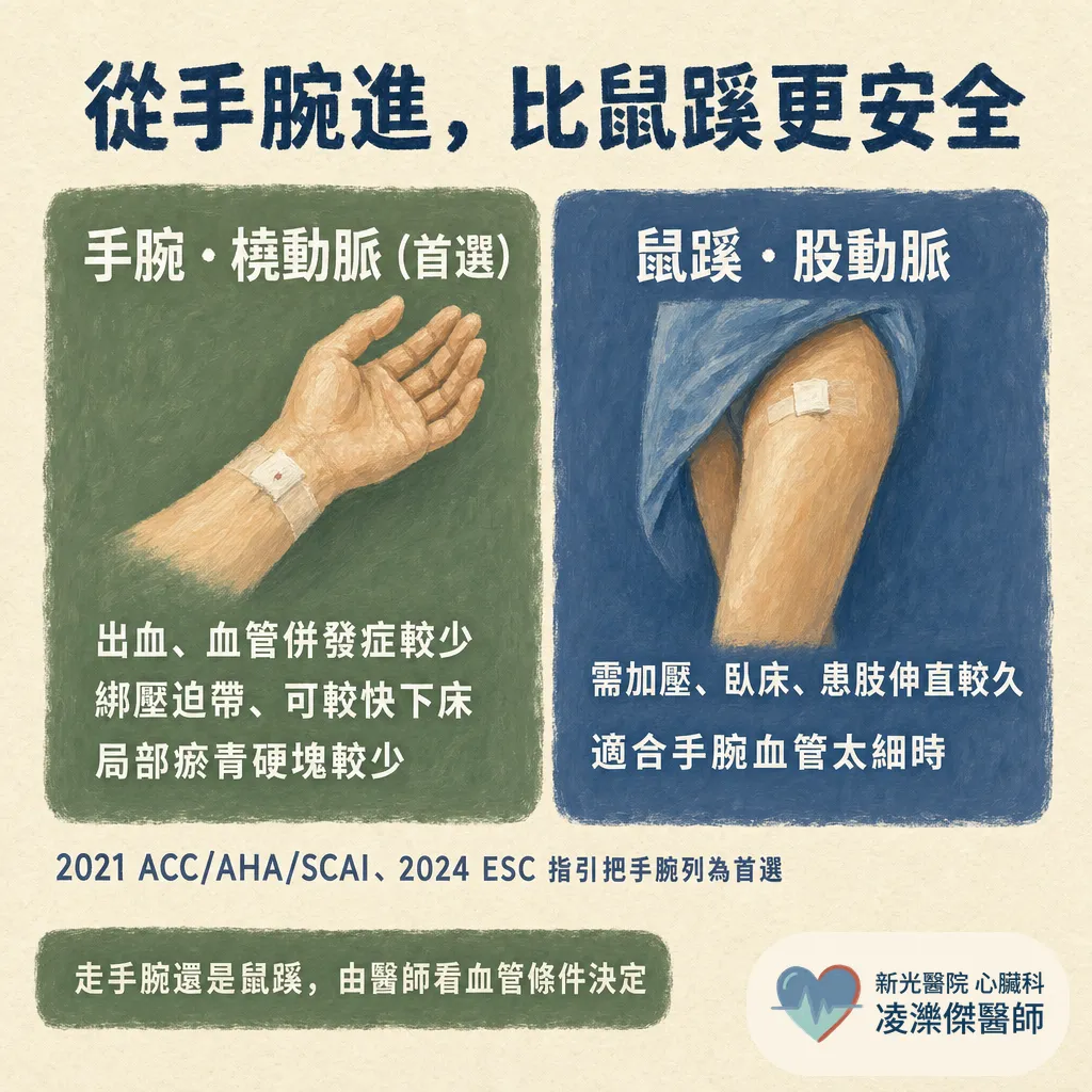 CAG 心導管檢查是什麼？不是開刀，流程與風險一次看懂 圖卡 3