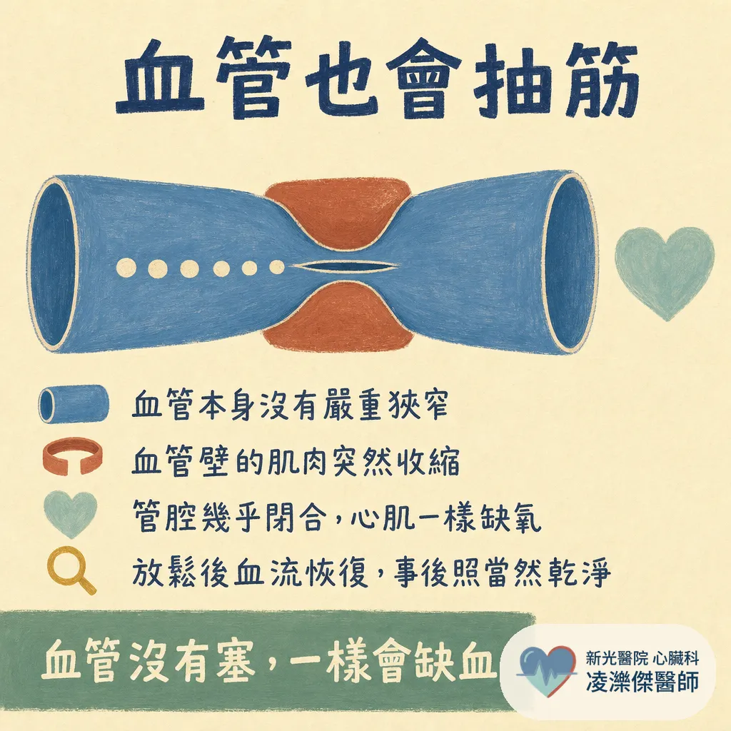 血管沒塞，為什麼還是胸痛？認識冠狀動脈痙攣（血管痙攣型心絞痛） 圖卡 2