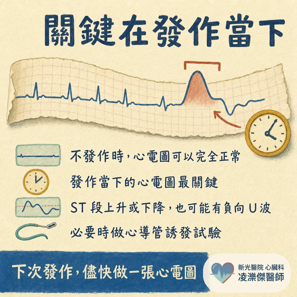 血管沒塞,為什麼還是胸痛?認識冠狀動脈痙攣(血管痙攣型心絞痛) 圖卡 5