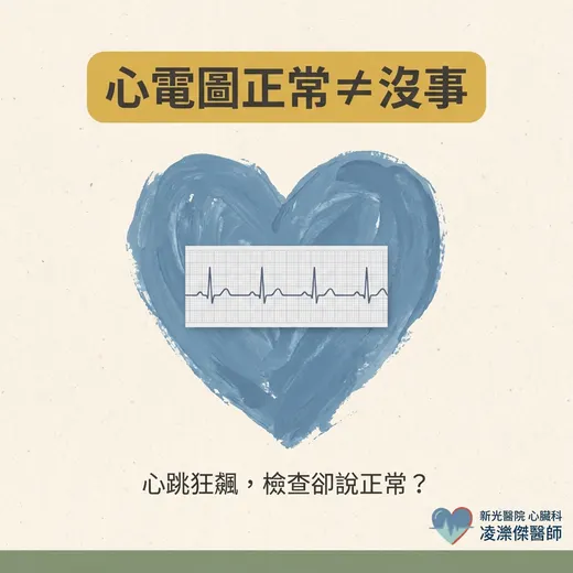 心電圖正常，心跳卻狂飆？——為什麼你可能需要長時間心律監測