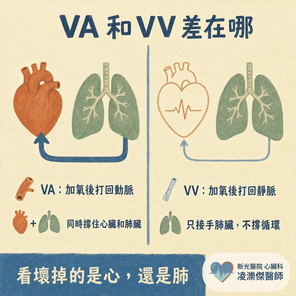 為什麼葉克膜不是一種「治療」?認識 ECMO:它能做什麼、不能做什麼 圖卡 3