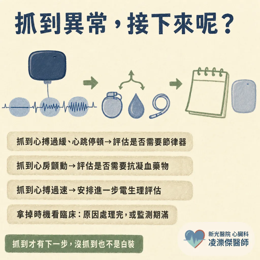 植入式心電圖記錄器(ILR)是什麼?反覆昏倒、中風找不到原因為什麼要裝、怎麼裝、能戴多久 圖卡 7