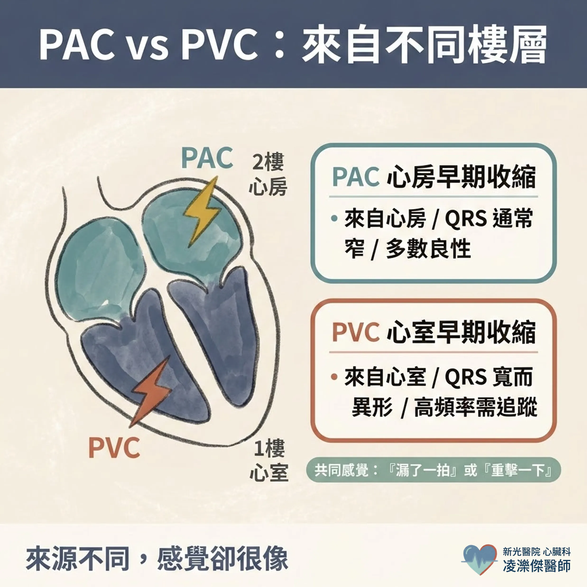 心臟偷跑了一拍:早期收縮(PAC/PVC)要治療嗎? 圖卡 3