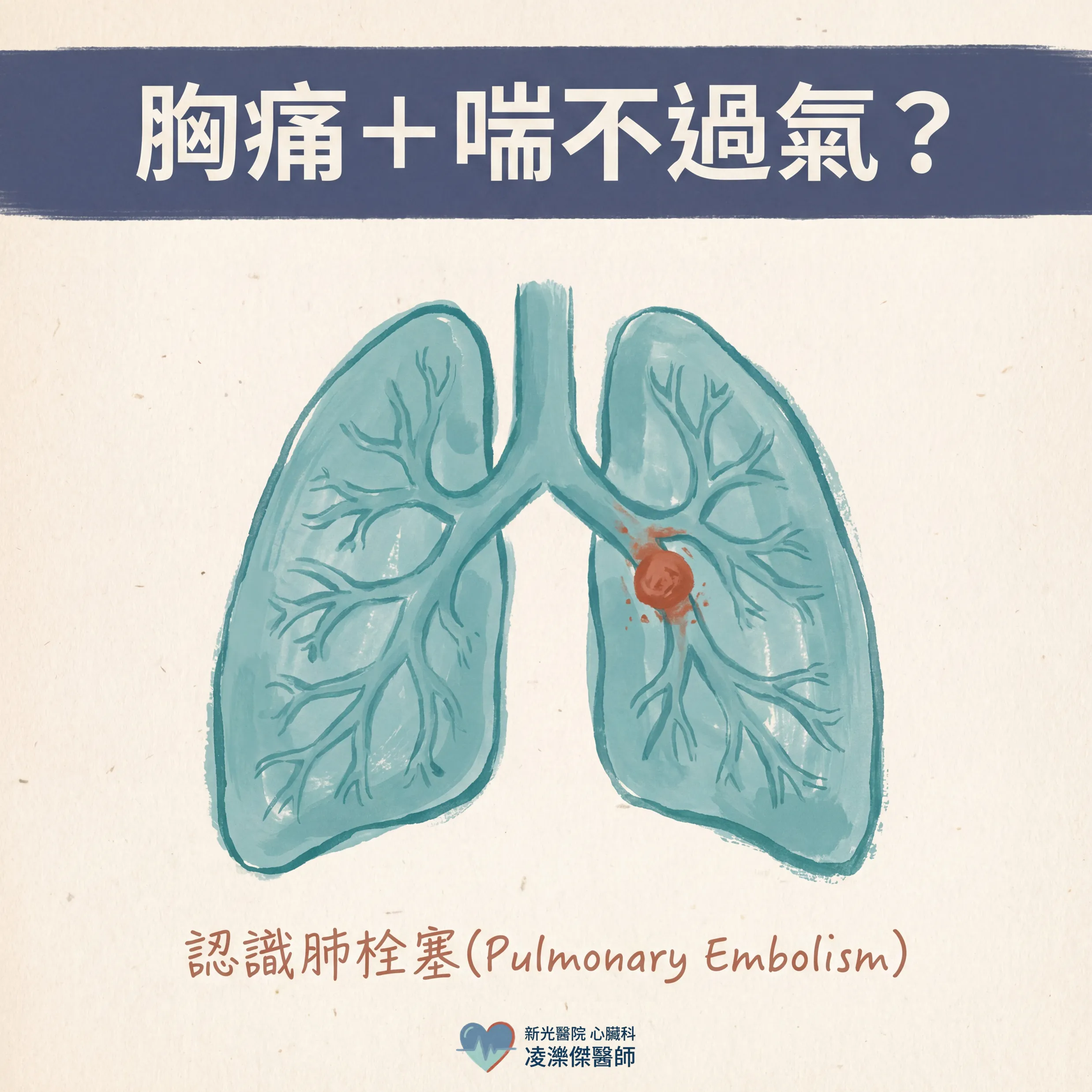 胸痛＋喘不過氣？小心肺栓塞 圖卡 1