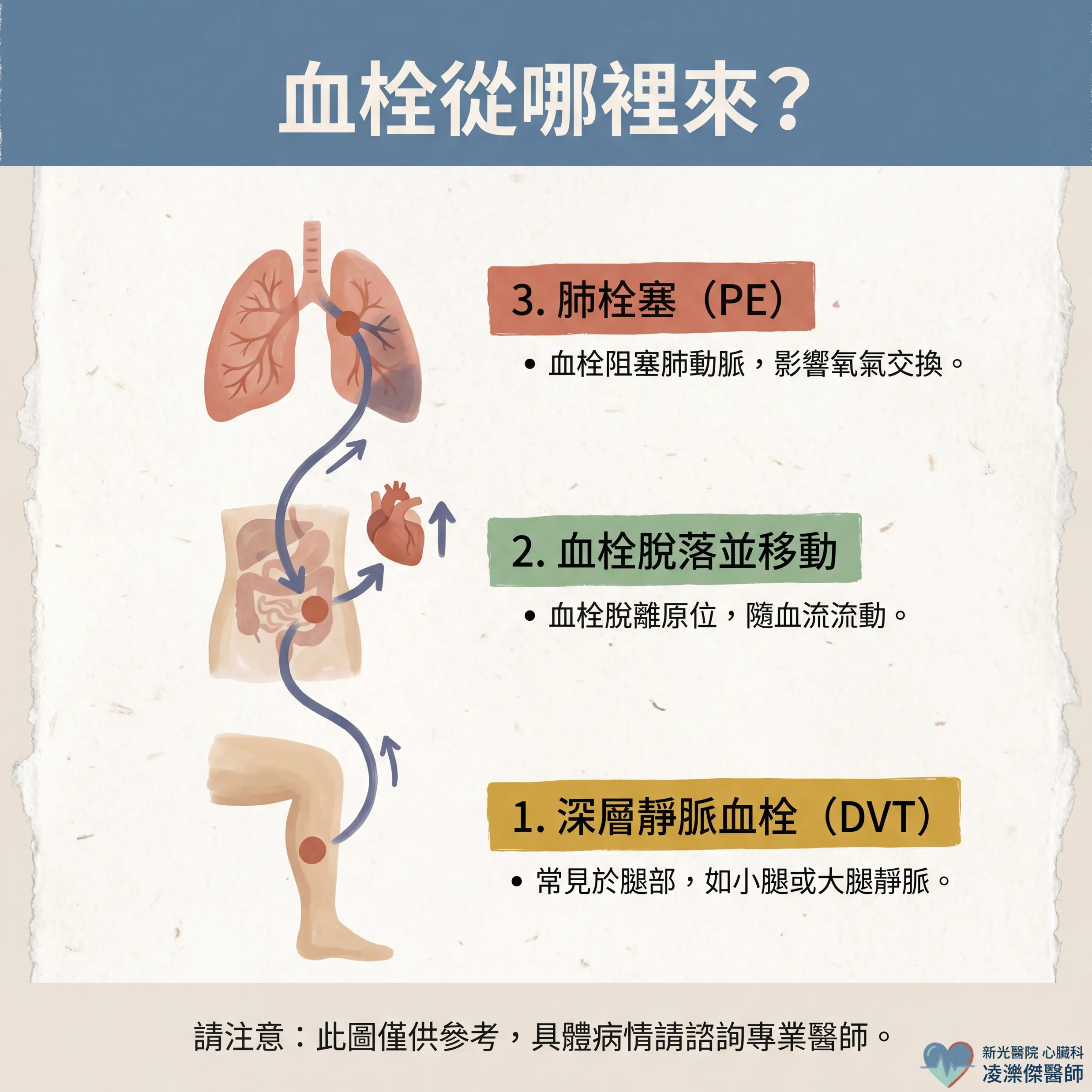胸痛＋喘不過氣？小心肺栓塞 圖卡 2