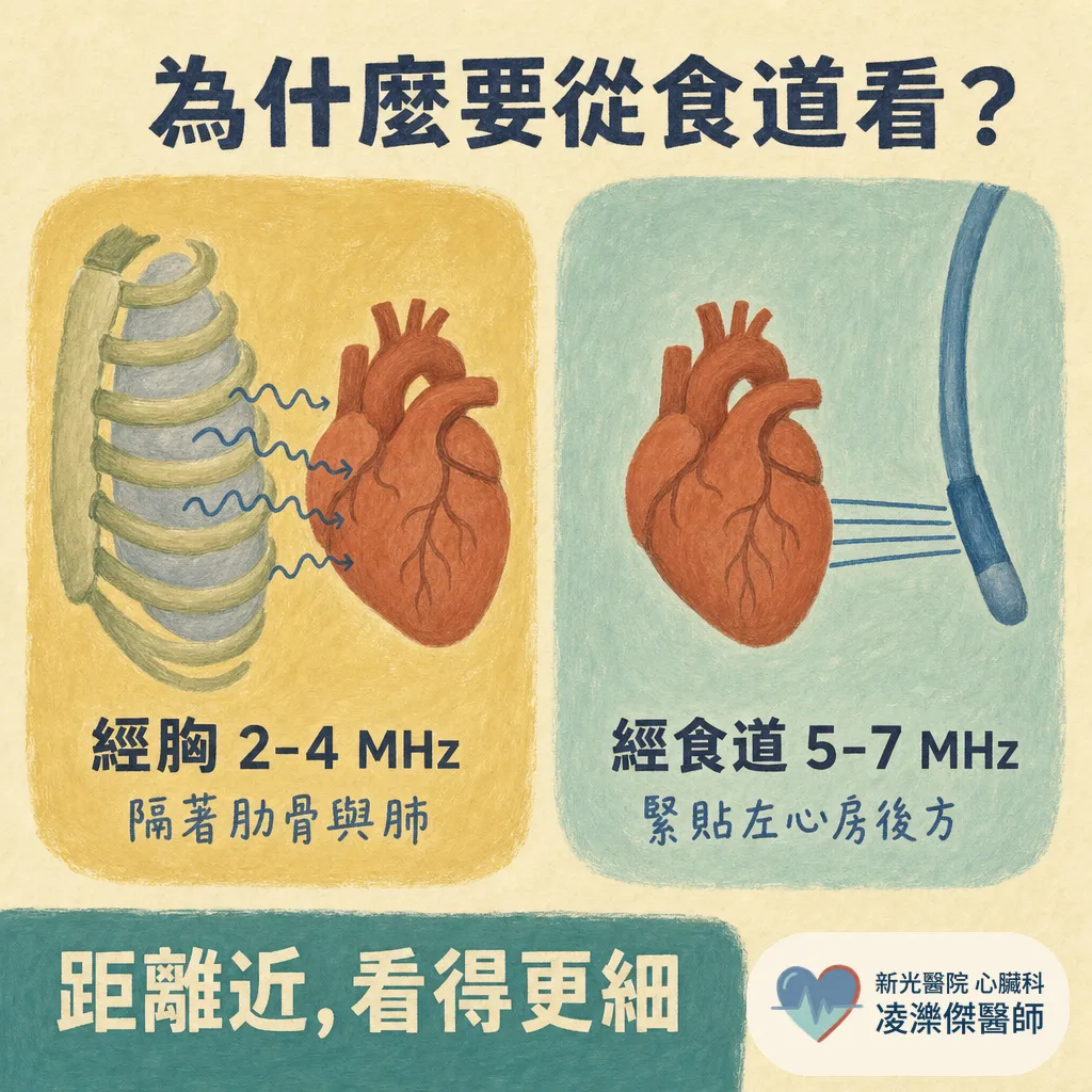 經食道心臟超音波(TEE)會不會很痛?在檢查什麼、流程與安全性一次說清楚 圖卡 2