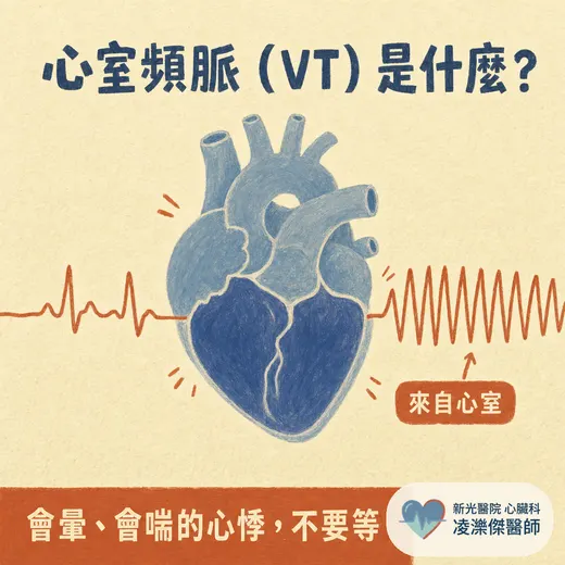 心室頻脈（VT）是什麼？跟一般心跳快哪裡不同、為什麼可能致命